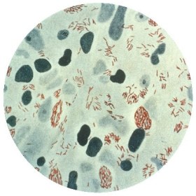 A photomicrograph of M. leprae from a leprosy skin lesion